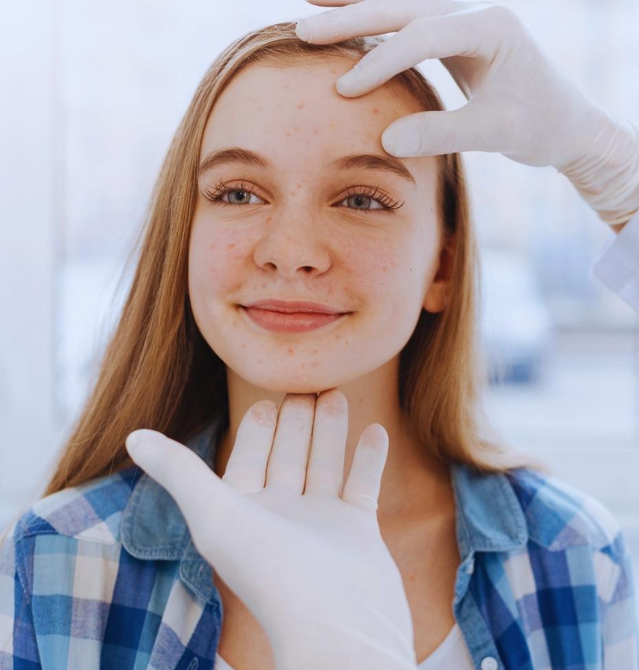 Avaliação da acne