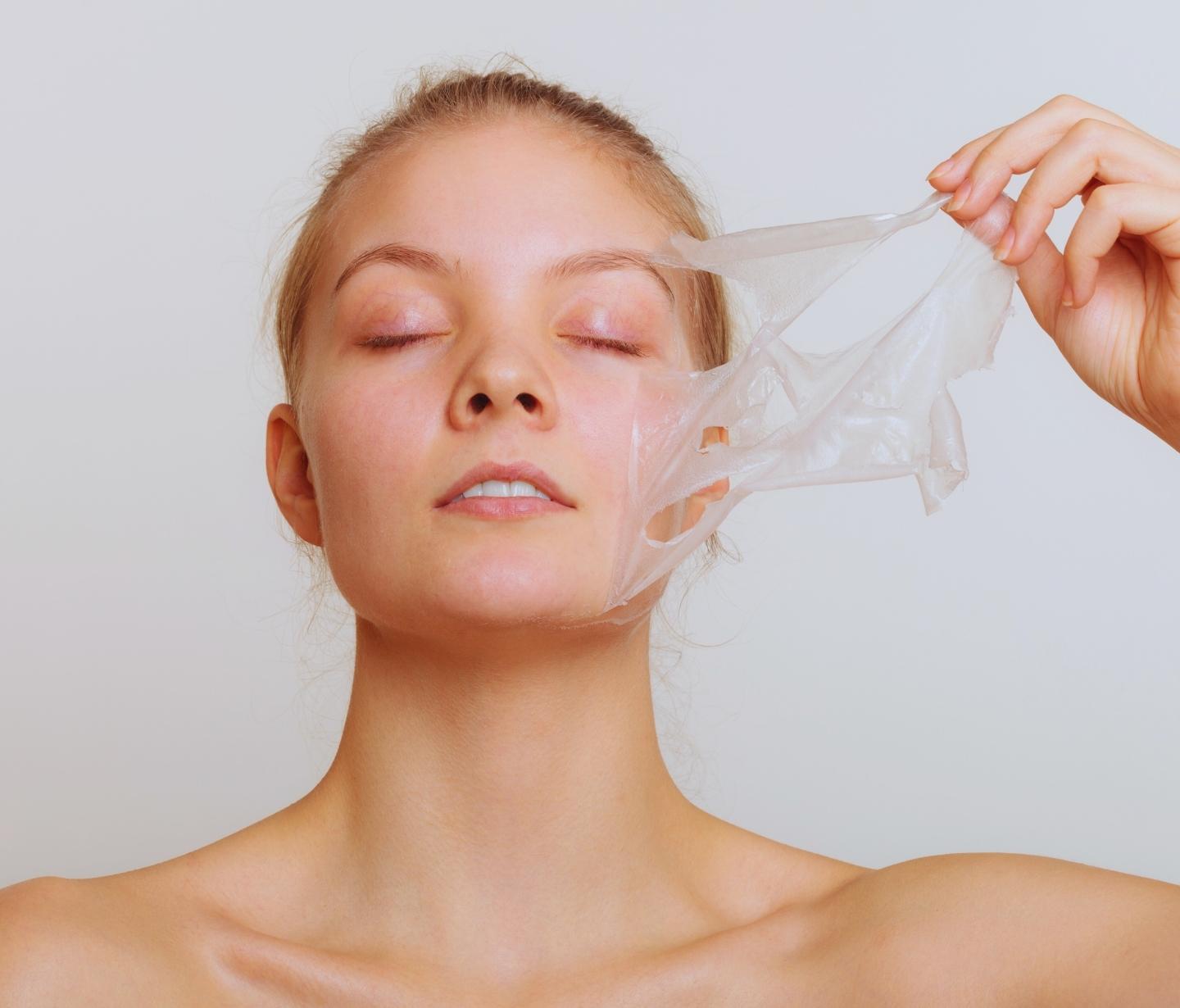 Resultados do peeling químico