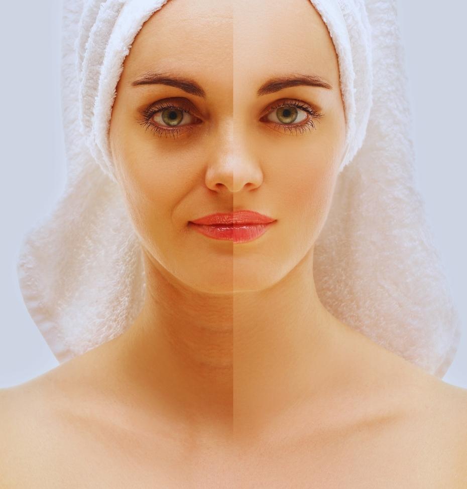 Tratamento com boosters dermatológicos